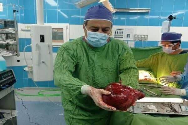 تومور ۳.۵ کیلویی از کلیه یک بیمار خارج شد +عکس