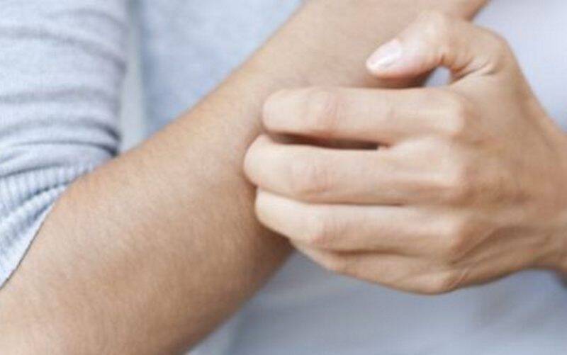 چگونه از بیماری‌های پوستی پیشگیری کنیم؟