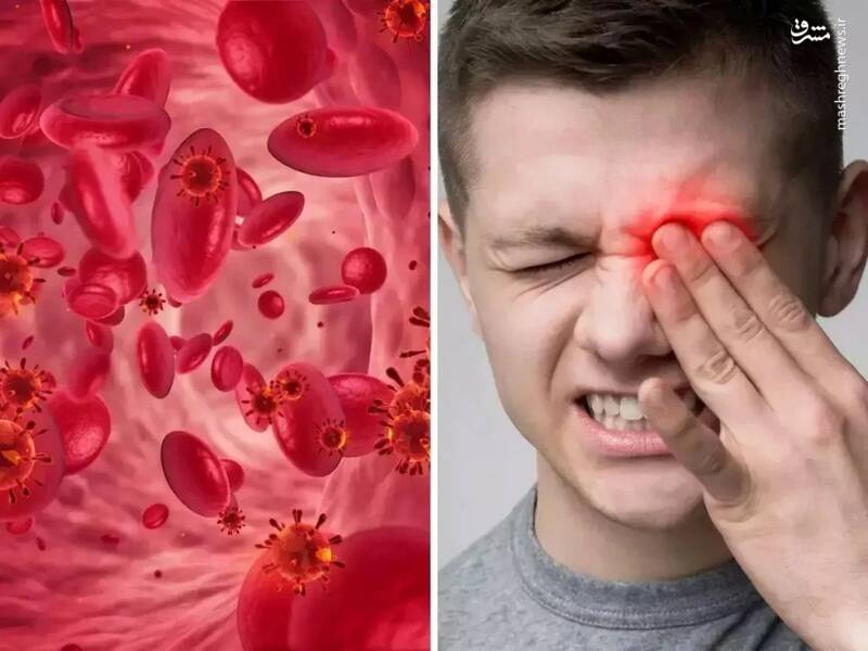 مشرق نیوز – اینفوگرافیک/ دلایل پایین‌بودن هموگلوبین در مردان چیست؟