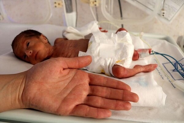 ترخیص نوزاد ۷۰۰ گرمی پس از ۴۸ روز تلاش شبانه‌روزی کادر درمان