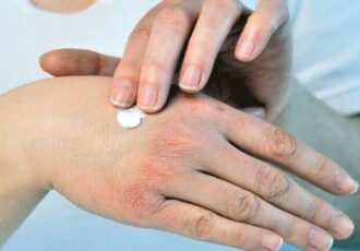 راهکارهای طب ایرانی برای حفظ سلامت پوست و بدن در فصل سرد