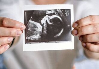 ویزیت رایگان مادران باردار ادامه دارد