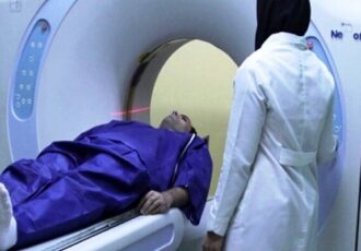 مقایسه ظرفیت دستگاه‌های MRI در تهران با انگلستان؛ ما جلوتریم!